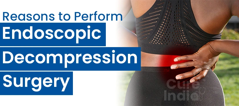 Reasons for Endosscopic Decompression Surgery in India